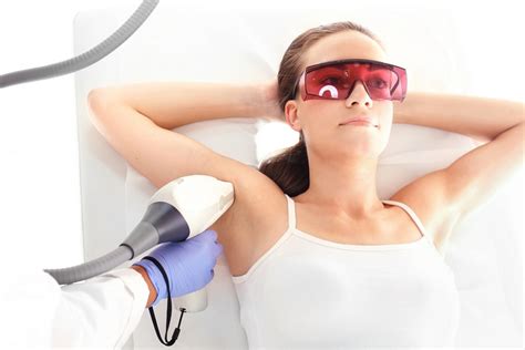 laser hair removal technology